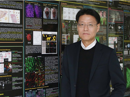 KAIST Identifies the Cause of Sepsis-induced Lung Injury 이미지
