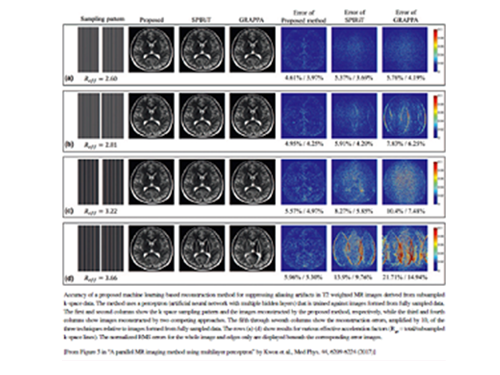 박현욱 교수, 머신러닝 통해 MRI 영상촬영시간 단축기술 개발 이미지