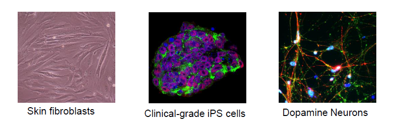 그림 3. 피부세포, 유도만능 줄기세포, 도파민 뉴런의 사진