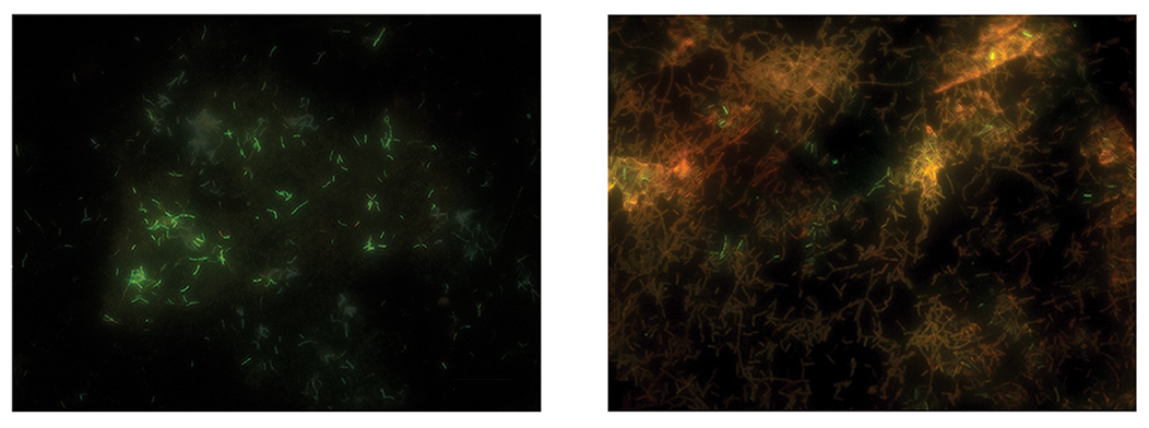 그림 3. 그래핀 액상 셀을 이용한 샘플과(좌) 일반 전자현미경 관찰한(우) 이후 형광분석법을 통한 세포의 생존성 검증. 살아 있는 세포는 녹색 형광을 보인다.