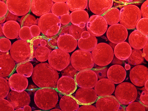 그림 3. 피하지방 혈관에서 발현되는 지방산전달인자. 피하지방 조직 내 혈관(초록색)에서 발현하는 지방산전달인자(파란색)의 이미지. 혈관에 존재하는 지방산전달인자들(초록색과 파란색이 겹쳐 노란색으로 보인다)이 혈중 지방을 지방세포(빨간색)로 전달한다는 것을 유추할 수 있다.