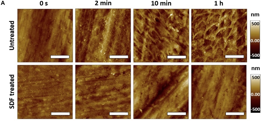 KAIST Scientifically Identifies a Method to Prevent Dental Erosion from Carbonated Drinks​ 이미지