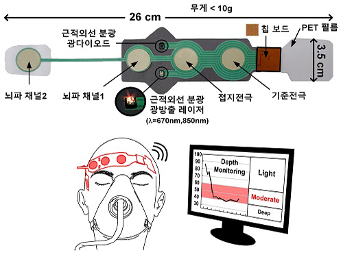 유회준 교수, 무선으로 마취 심도 측정할 수 있는 기술 개발 이미지