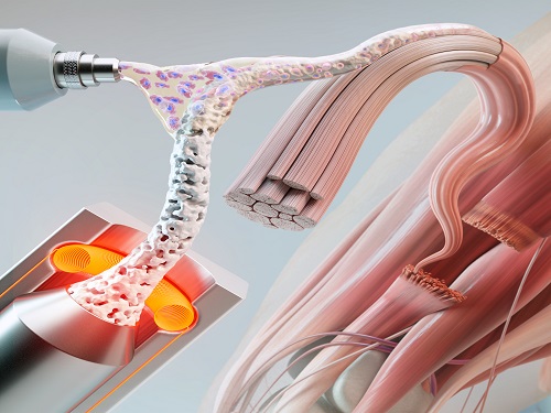 인공근육 재생을 위한 세포기반 3D 파이버 구조체 개발 이미지