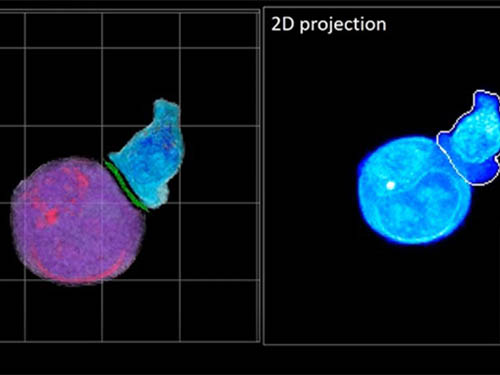 Deep-Learning and 3D Holographic Microscopy Beats Scientists at Analyzing Cancer Immunotherapy 이미지
