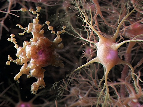 노화된 뇌에서 생겨난 비정상적 별아교세포 '아프다(APDA)' 발견 이미지