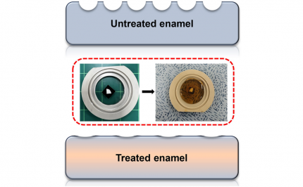 KAIST Scientifically Identifies a Method to Prevent Dental Erosion from Carbonated Drinks 이미지