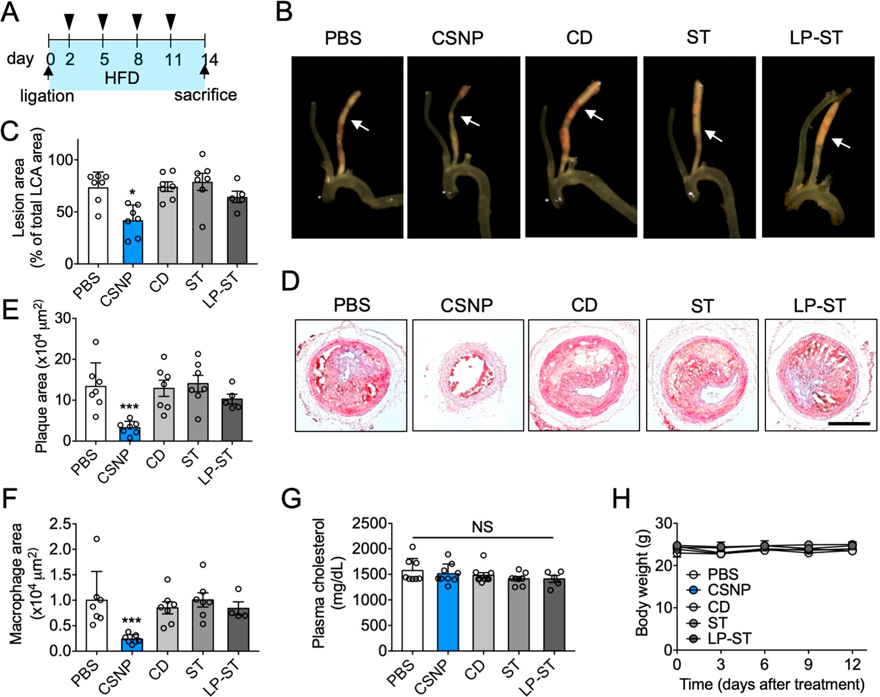 Figure. Antiatherogenic effect of CSNP.