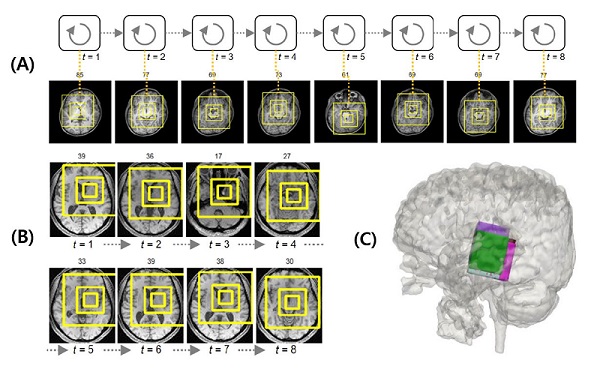 딥러닝을 통한 자폐 환자 MRI 영상 분석