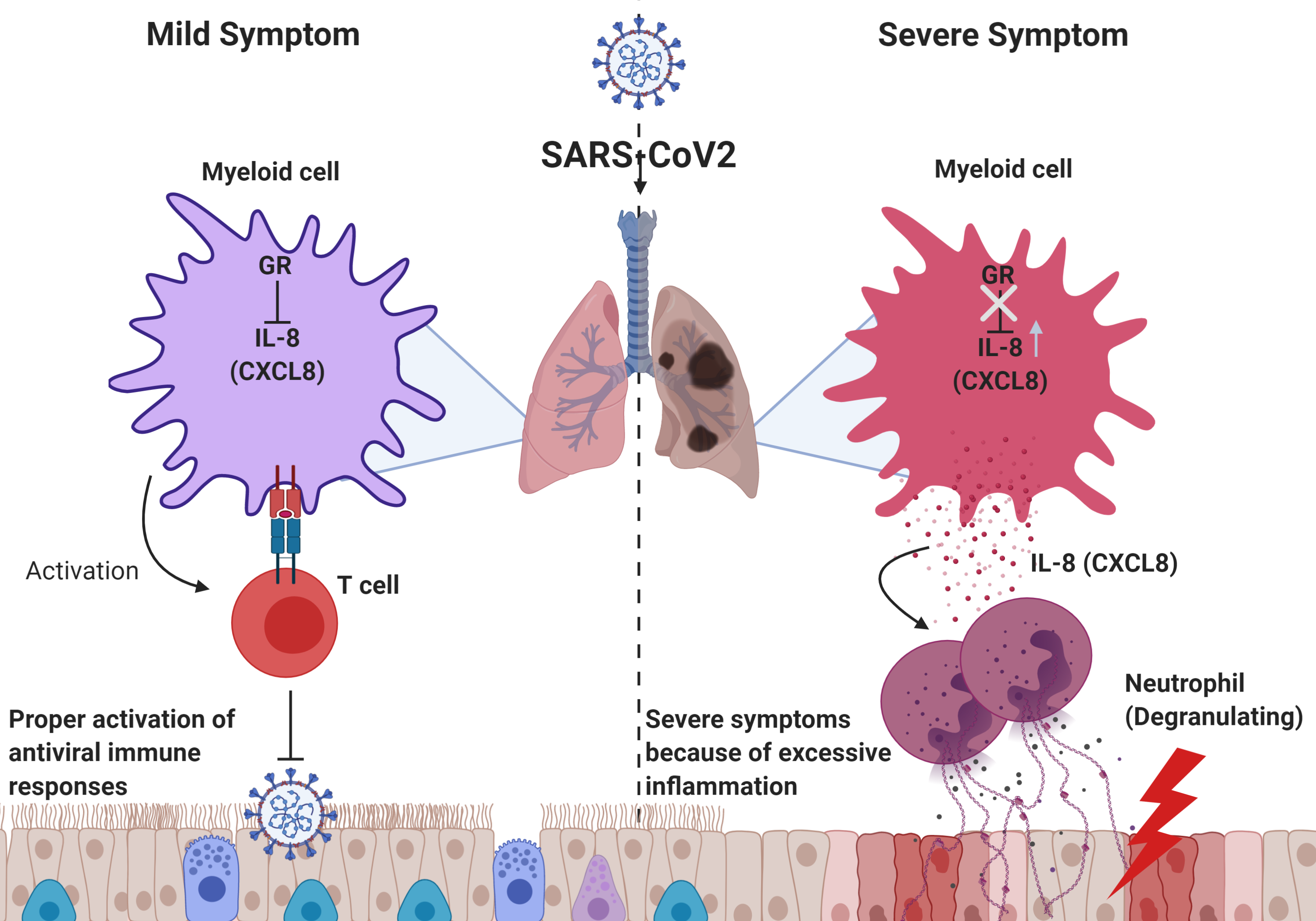 Figure. Low glucocorticoid receptor (GR) expression led to excessive inflammation and lung damage by neutrophils through enhancing the expression of CXCL8 and other cytokines.