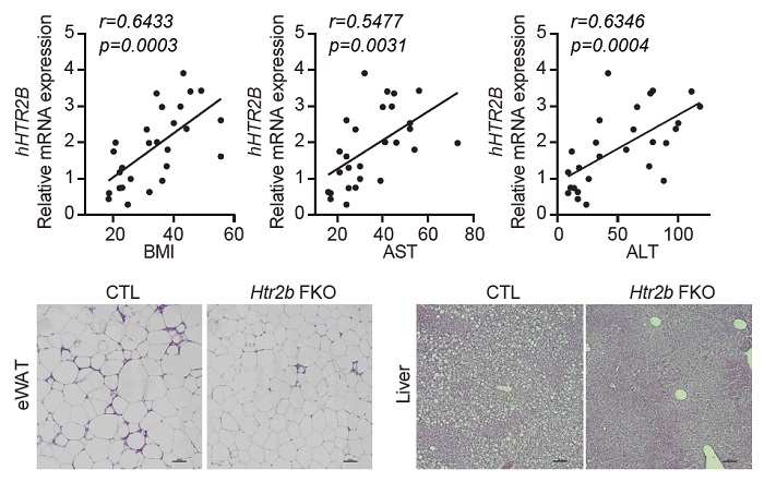 그림 2. 사람의 내장지방에서 세로토닌 수용체 2B 발현양과 BMI, AST, ALT(간지표)와의 상관관계 등