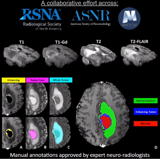 Brain Tumor Segmentation (BRATS) Challenge