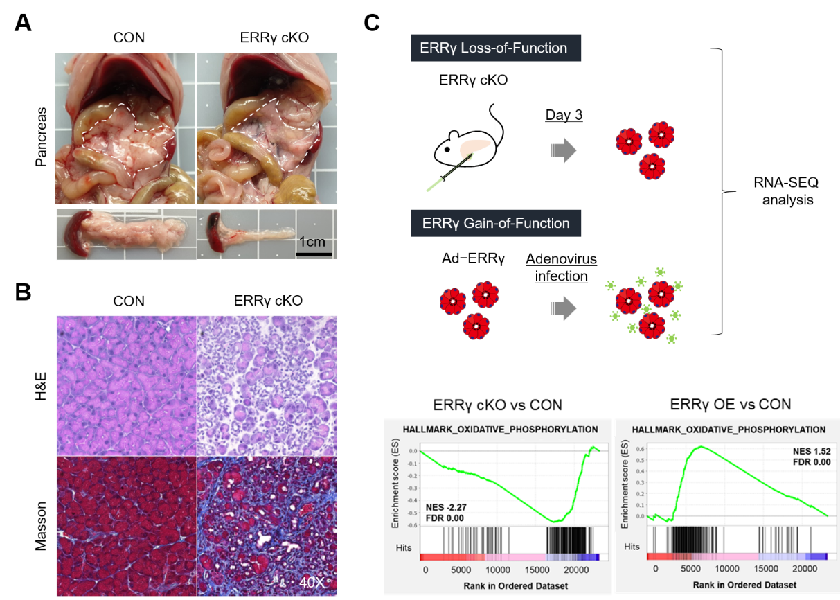 그림 1. ERRγ에 의한 미토콘드리아 전사조절이 췌장 선방세포(acinar cell)의 에너지 대사와 생리 기능 유지에 중요한 역할을 가지고 있음을 밝혔다. 췌장에서의 ERRγ 유전자 결손은 염증반응, 섬유화, 및 세포사멸을 동반한 췌장염과 유사한 표현형을 유발하였다. 특히, 췌장 선방세포에서 ERRγ 발현 조절을 통해 미토콘드리아 전사체 조절에 중요한 역할을 지니고 있음을 확인하였다.