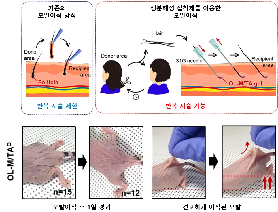 그림 2. (위) 모낭을 포함하는 모발을 이식하는 기존의 모발 이식 방식(왼쪽) 대비 생분해성 접착제를 이용한 모발 이식 방식(오른쪽)의 개요. 모발 끝에 접착제를 도포한 후 피하주사를 통해 이식함으로써 피부에 고정하며, 반복 시술이 가능하다. (아래) 초기 동물실험 결과. 15가닥의 모발을 이식한 후 1일 경과한 상태에서 12가닥의 모발이 남아있다. 3가닥의 모발을 잡아당기면 몸 전체가 끌려올라오는 것으로 보아 피부에 견고하게 이식된 것을 알 수 있다. 접착제를 사용하지 않으면 모발이 남지 않으며, 열처리하지 않은 접착제의 경우 1/7 수준의 효율을 보였다. 