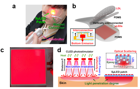 (1)	The overall concept of SµLED patch