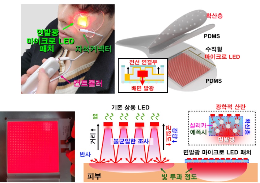 그림 1. 면발광 마이크로 LED 패치