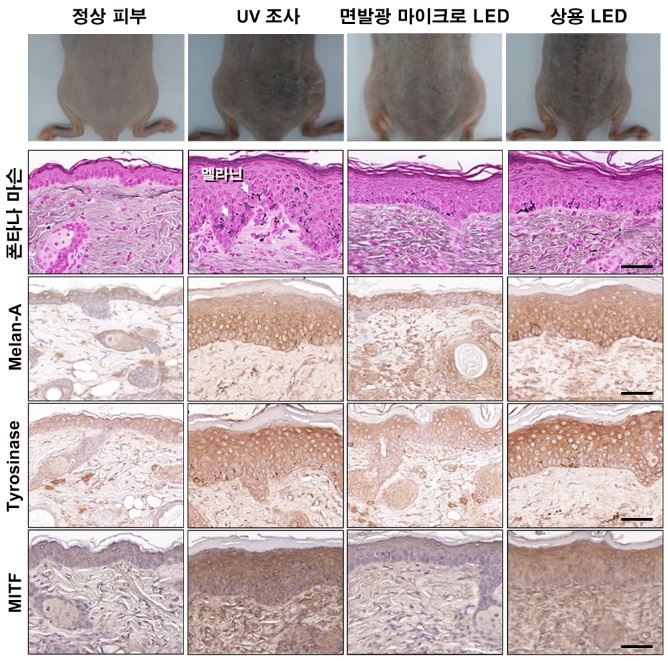 그림 3. 쥐 실험을 통한 면발광 마이크로 LED 패치의 멜라닌 생성 억제 효과