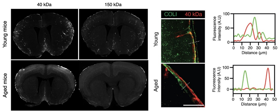 Figure 3. Substance flux through the brain membrane decreases with aging. 