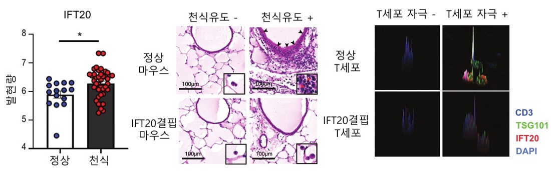 정상인에 비해서 천식환자에게서 혈액내의 IFT20발현량이 증가되어 있음. T세포에 국한되어 IFT20이 결핍된 마우스는 정상마우스에 비해서 천식유도가 잘 되지 않음. IFT20이 결핍된 T세포는 정상 T세포에 비해 면역학적 시냅스 형성이 잘 되지 않음.