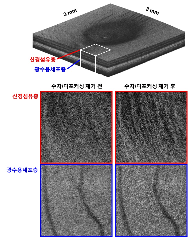 그림 1. 넓은 영역에 걸친 3차원 전부분 세포수준 고해상도 망막 이미징