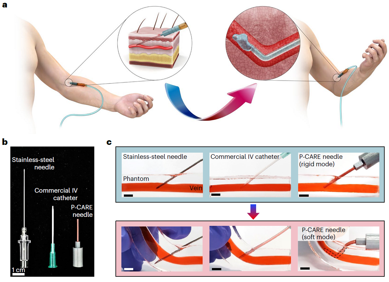 Body heat activates IV needle to soften irreversibly upon insertion