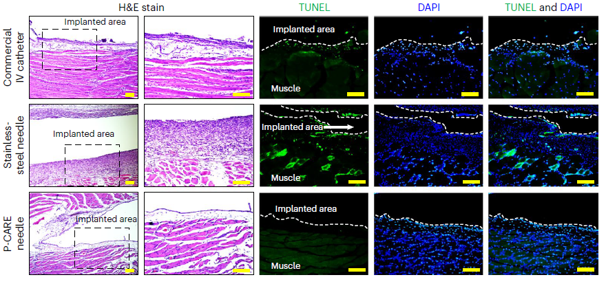 Conceptual images of potential utilization for temperature monitoring function of P-CARE needle 