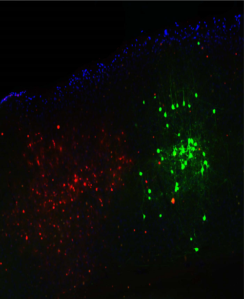 그림 1. 형광물질을 발현시킨 뇌 절편 영상에서의 신경세포의 분포
