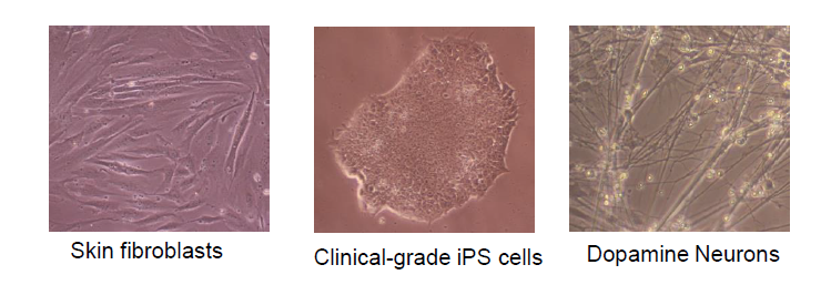 그림 2. 피부세포, 유도만능 줄기세포, 도파민 뉴런의 사진
