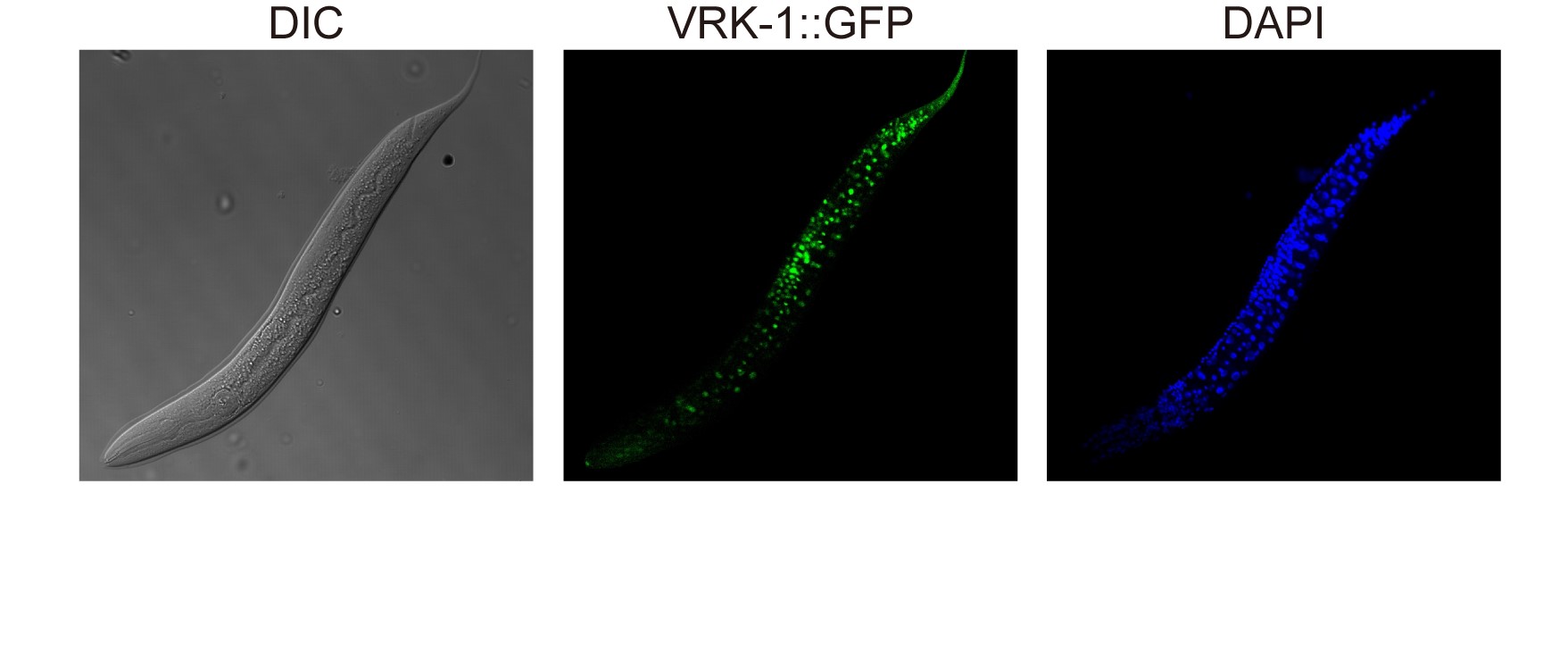 Image. VRK-1 that was visualized by tagging with green fluorescence protein (GFP) in C. elegans.