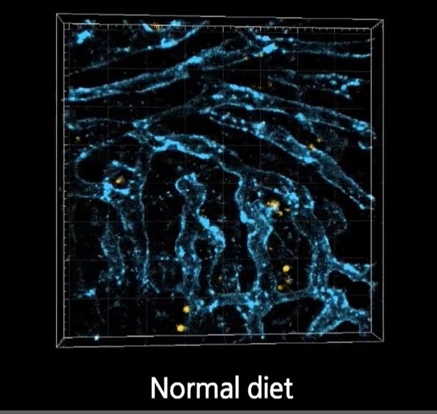 Image 2: The researchers used their intravital imaging method to capture 3D images of lipid droplet accumulation (yellow) and microvasculature (blue) in the livers of normal mice and mice with nonalcoholic fatty liver disease that is induced with a methionine and choline deficient (MCD).