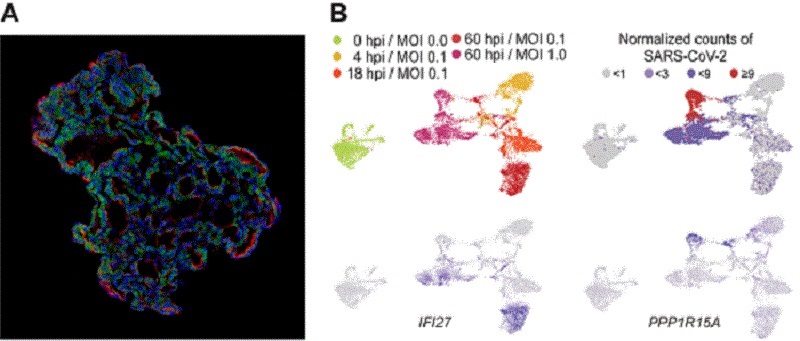 (A)Representative image of three-dimensional human lung alveolar organoid showing alveolar stem cell marker, HTII-280 (red) and SARS-CoV-2 entry protein, ACE2 (green) (left panel). (B)Plot for single cell RNA sequencing. SARS-CoV-2 infected alveolar stem cells were heterogeneous: immune-proficient cells with moderate burden of SARS-CoV-2 and immune-deficient cells with high burden of SARS-CoV-2. hpi; hours post infection, MOI: multiplicity of infection, which means number of viral particles per a cell.