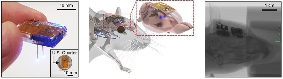 그림 1. 개발된 뇌 이식용 무선 디바이스