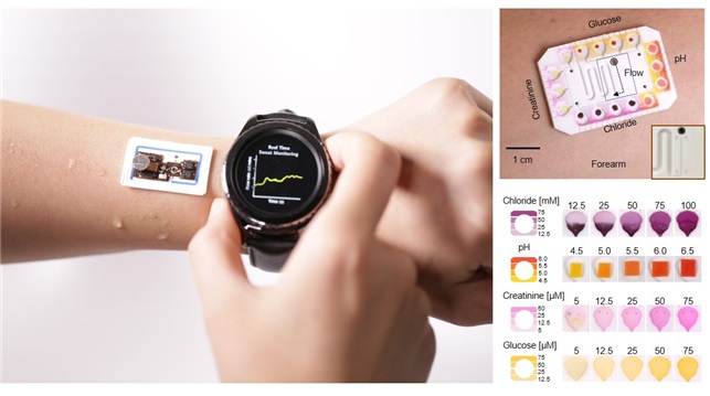 Sweat as a source of biomarkers. A wireless electronic patch (left) measures sweat's volumetric flow and cumulative loss. It can be combined with the microfluidic system (right) that provides pH measurements and determines the concentration of chloride, creatine, and glucose in a user's sweat. These indicators could be used to diagnose cystic fibrosis, diabetes, kidney dysfunction, and metabolic alkalosis.