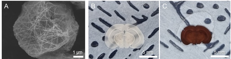 그림 2. (A) 세포의 미세소관을 표적화하여 금속 입자를 성장시킨 뒤 측정한 전자현미경 이미지. (B) 쥐의 뇌 슬라이스 (slice) (C) 신경 세포를 표적화하여 금속 입자를 성장시킨 쥐의 뇌 슬라이스.  