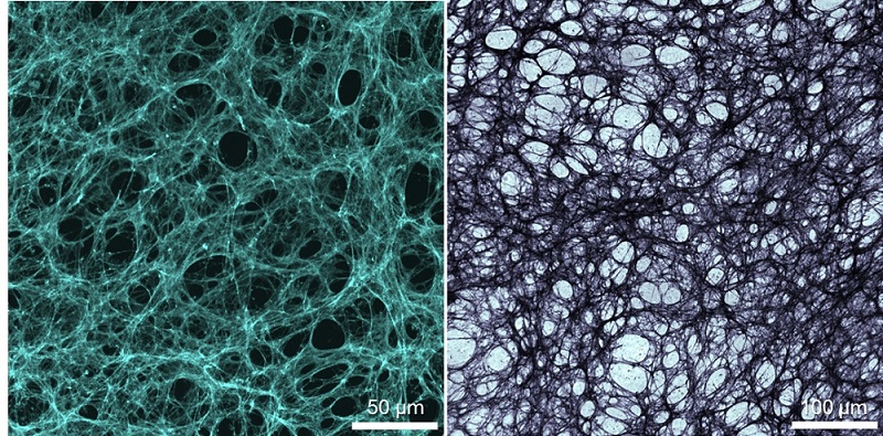 그림 2. 본 연구에 사용한 NIH/3T3 세포에서 유래한 피브로넥틴 형광 현미경 이미지와 이를 모방한 금속 구조체의 명시야 현미경 이미지